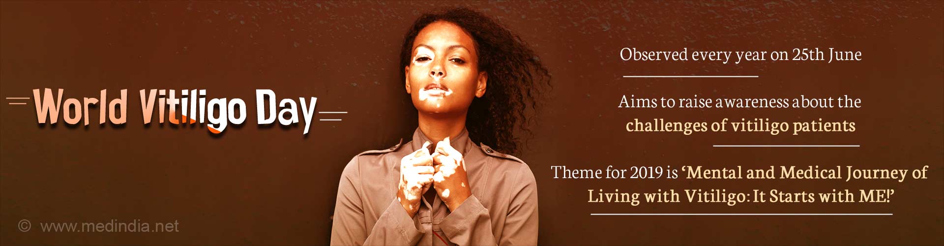 World Vitiligo Day: Focus on Mental Health