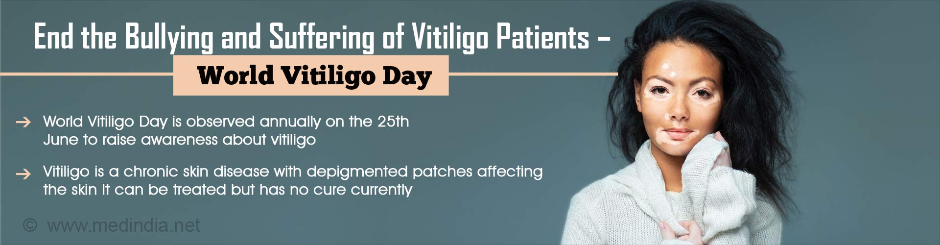 Vitiligo is a Skin Disease Worthy of Attention - World Vitiligo Day