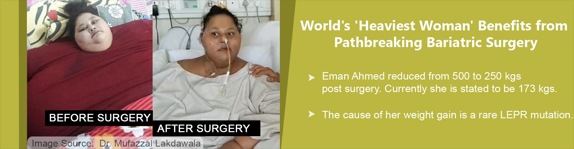 Exclusive Interview With Dr. Muffazal Lakdawala - Bariatric Surgeon of 500kg Egyptian Woman Exclusive Interview With Dr. Muffazal Lakdawala - Bariatric Surgeon of 500kg Egyptian Woman