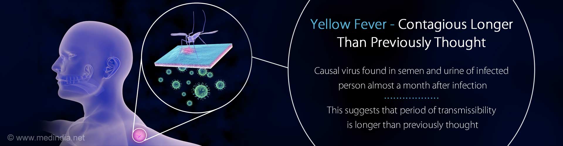 Yellow Fever may be Contagious Longer Than Previously Thought Yellow Fever may be Contagious Longer Than Previously Thought