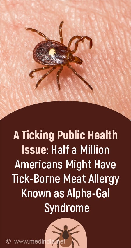 The Bite of a Lone Star Tick Can Cause Alpha-Gal Syndrome, an