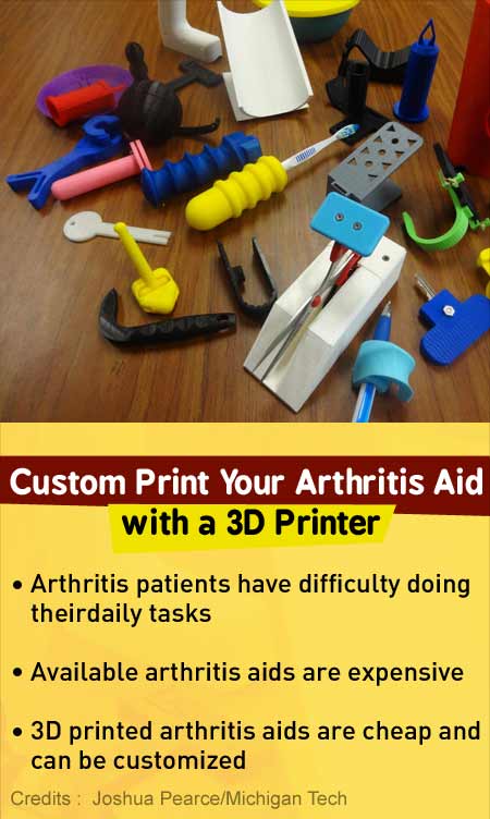 3-D Printing Offers Helping Hand to Patients with Arthritis