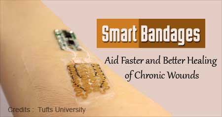 Smart bandages which tell doctor how wound is healing to begin