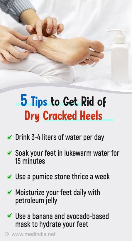 How to take Care of Cracked Heels Naturally ?