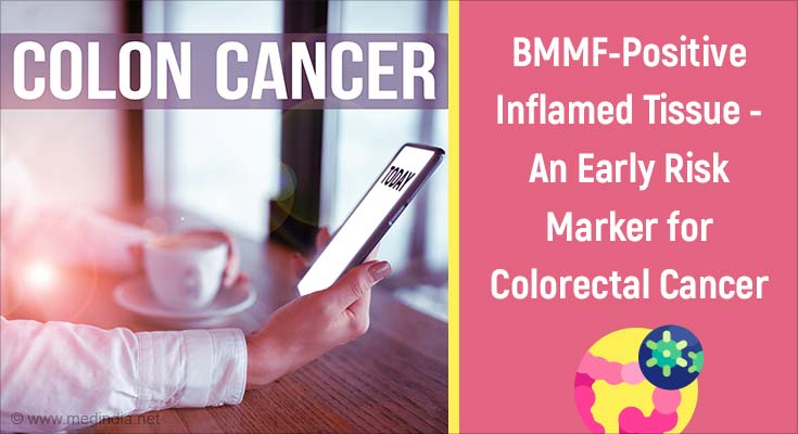 Role of Bovine Meat and Milk Factors in Colorectal Cancer