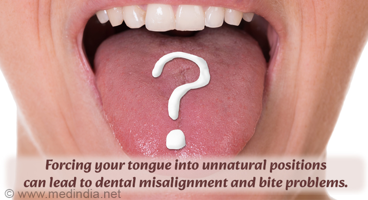 Dental Misalignment and Bite Problems Dental Misalignment and Bite Problems