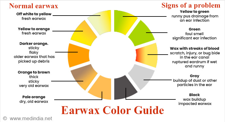 Earwax Color Guide