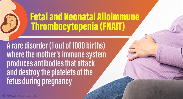 Fetomaternal Alloimmune Thrombocytopenia Fmait Explained