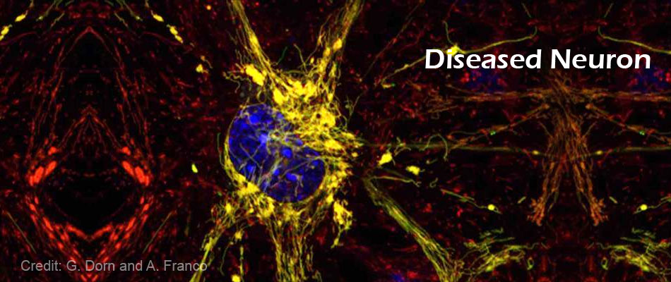 Charcot-Marie-Tooth Disease - New Findings Charcot-Marie-Tooth Disease - New Findings