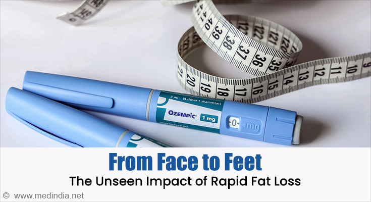 Rapid Fat Loss Rapid Fat Loss