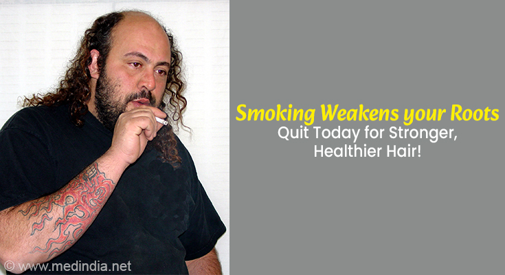 Smoking Hair loss Smoking Hair loss