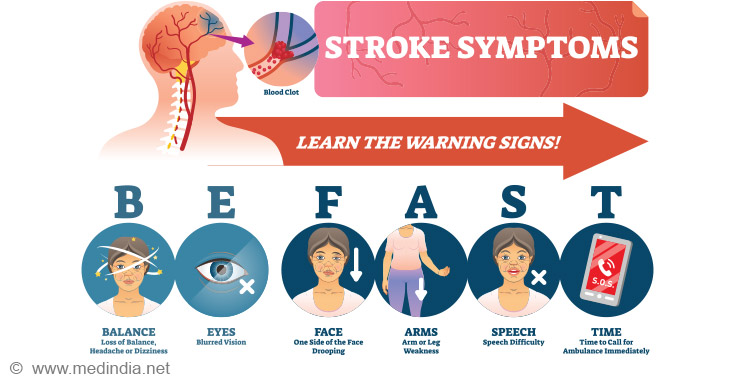 stroke-symptoms.jpg