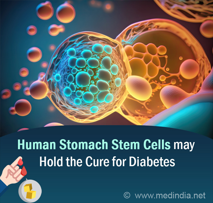 Stem Cells in Your Stomach can be the Key to Treating Diabetes