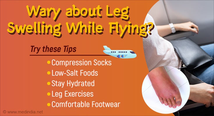 Why Does Foot Swelling Occur While Flying 