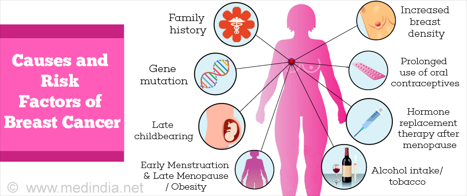 Causes and of alcoholRisk Factors of Breast Cancer Causes and of alcoholRisk Factors of Breast Cancer