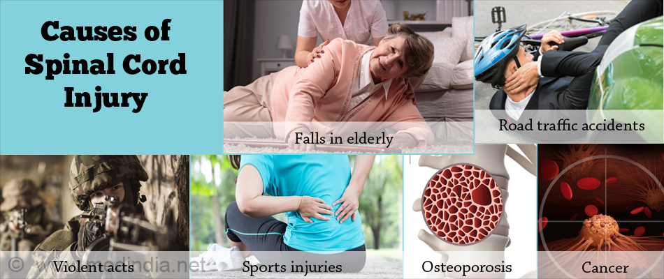 Causes of Spinal Cord Injury Causes of Spinal Cord Injury