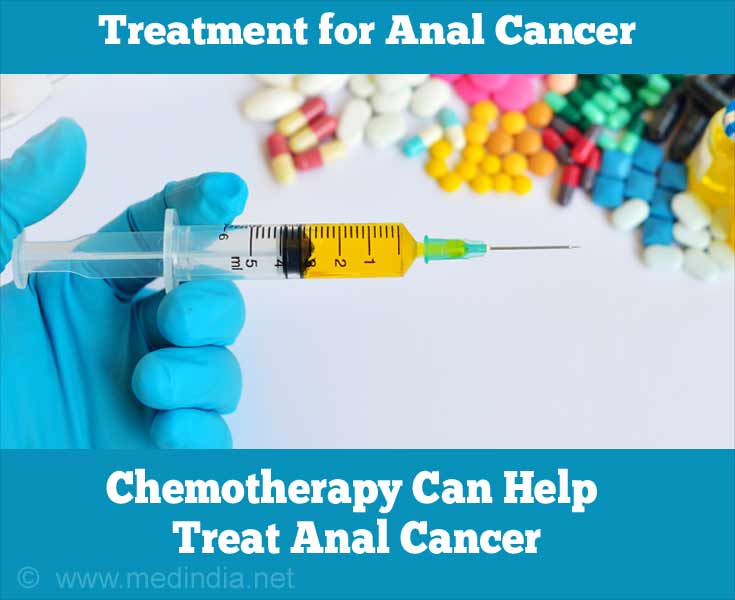 Chemotherapy Can Help Treat Anal Cancer Chemotherapy Can Help Treat Anal Cancer