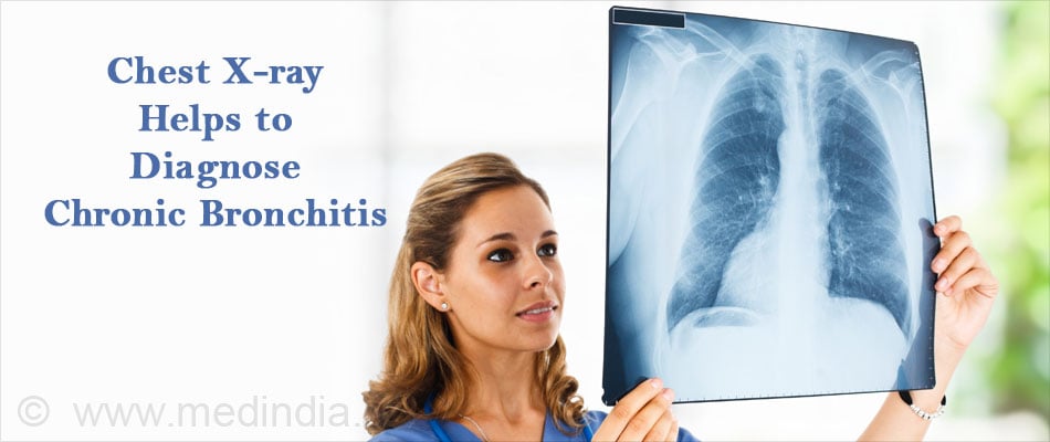 Chest X-ray Helps to Diagnose Chronic Bronchitis Chest X-ray Helps to Diagnose Chronic Bronchitis