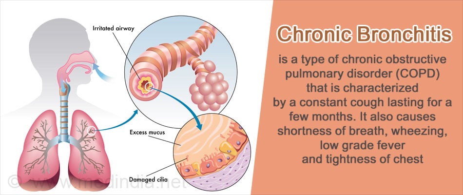 Chronic Bronchitis Chronic Bronchitis