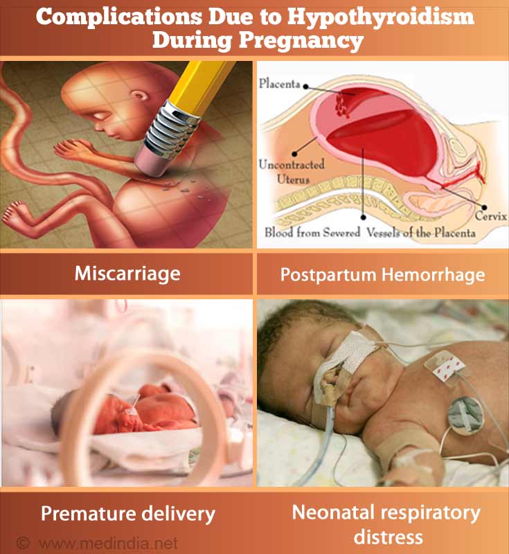 Complications Due To Hypothyroidism During Pregnancy Complications Due To Hypothyroidism During Pregnancy