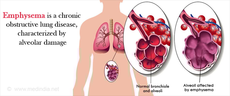 Emphysema Emphysema