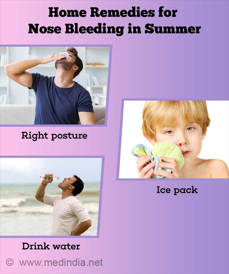 Home Remedies for Nose Bleeding in Summer Home Remedies for Nose Bleeding in Summer