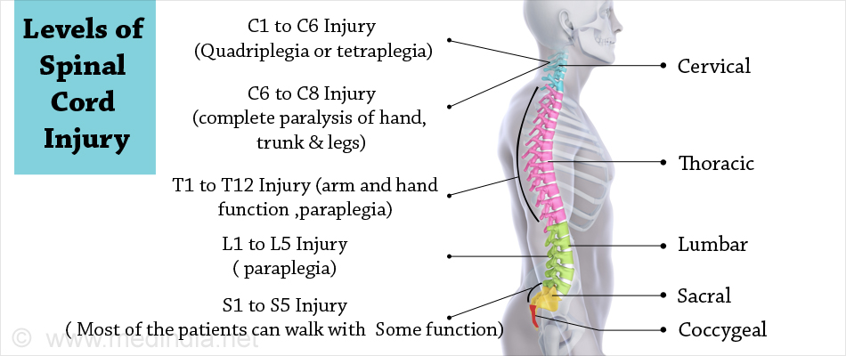Levels of Spinal Cord Injury Levels of Spinal Cord Injury