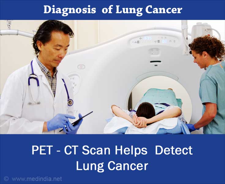 Lung Cancer Diagnosis - PET-CT Scan Lung Cancer Diagnosis - PET-CT Scan