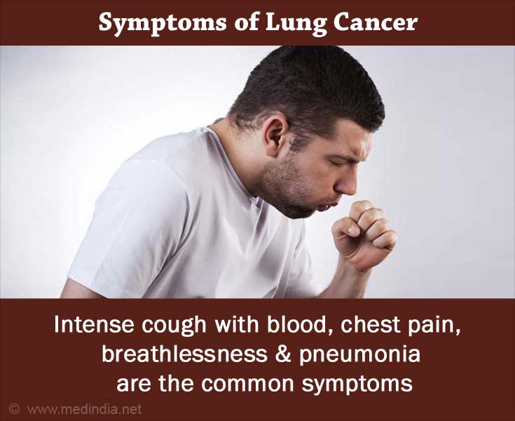 Lung Cancer Symptoms � Intense Cough Lung Cancer Symptoms � Intense Cough