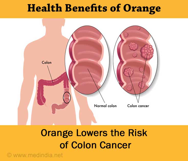 Orange Lowers Colon Cancer Risk Orange Lowers Colon Cancer Risk