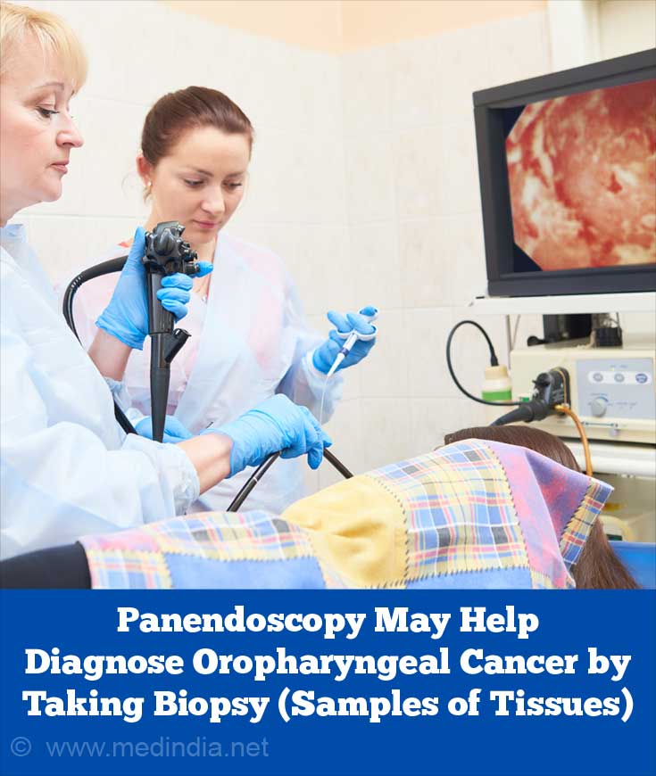 Panendoscopy May Help Diagnose Oropharyngeal Cancer Panendoscopy May Help Diagnose Oropharyngeal Cancer
