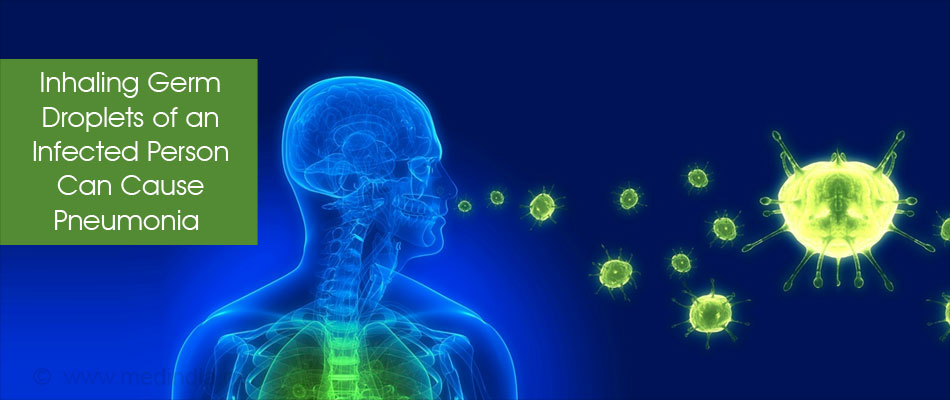 Pneumonia is Caused by Various Types of Germs Pneumonia is Caused by Various Types of Germs