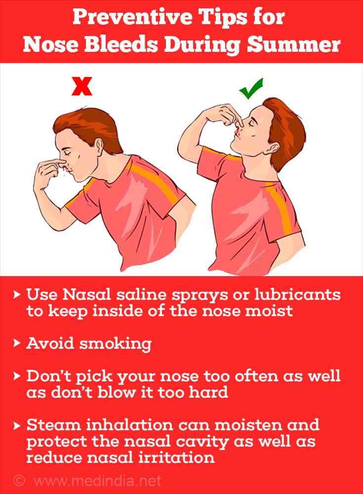 Preventive tips for Nose Bleeds During Summer Preventive tips for Nose Bleeds During Summer