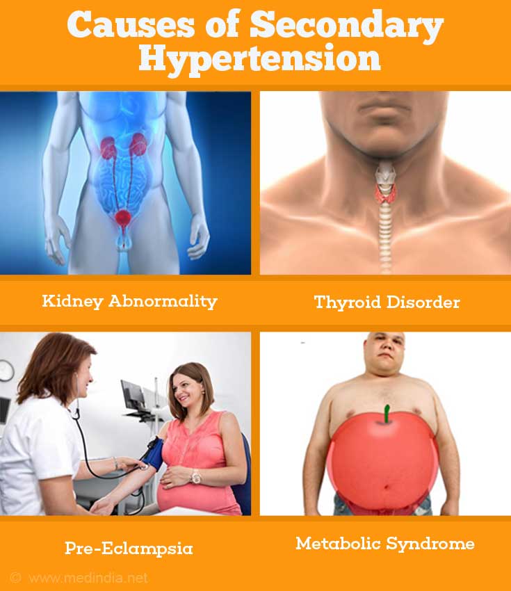Causes of Secondary Hypertension Causes of Secondary Hypertension