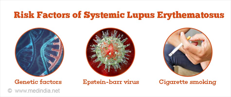 Risk Factors of Systemic Lupus Erythematosus Risk Factors of Systemic Lupus Erythematosus