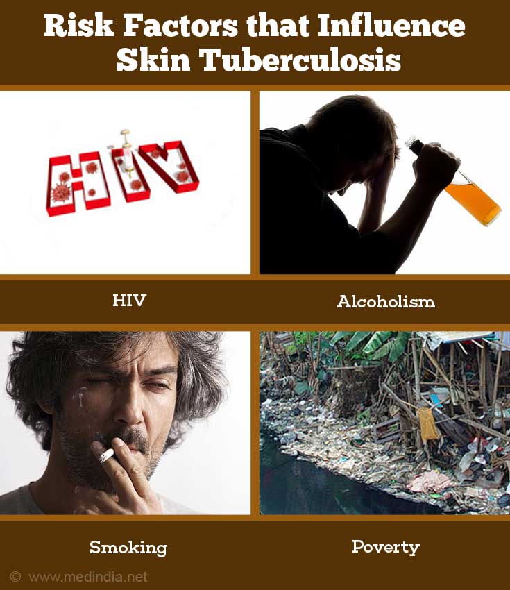 Risk Factors that Influence Skin Tuberculosis Risk Factors that Influence Skin Tuberculosis