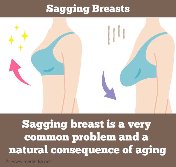 Sagging Breasts Sagging Breasts