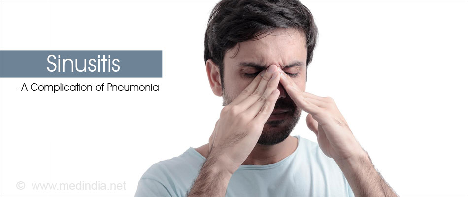 Sinusitis - A Complications of Pneumonia Sinusitis - A Complications of Pneumonia