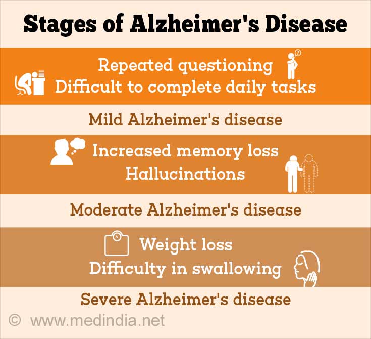 Stages of Alzheimer’s Disease Stages of Alzheimer’s Disease