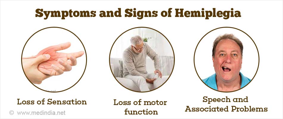 Symptoms and Signs of Hemiplegia Symptoms and Signs of Hemiplegia