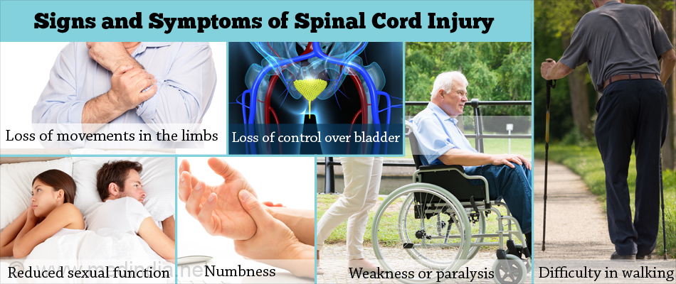 Symptoms & Signs of Spinal Cord Injury Symptoms & Signs of Spinal Cord Injury