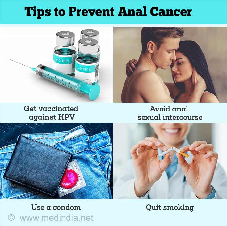 Tips to Prevent Anal Cancer Tips to Prevent Anal Cancer