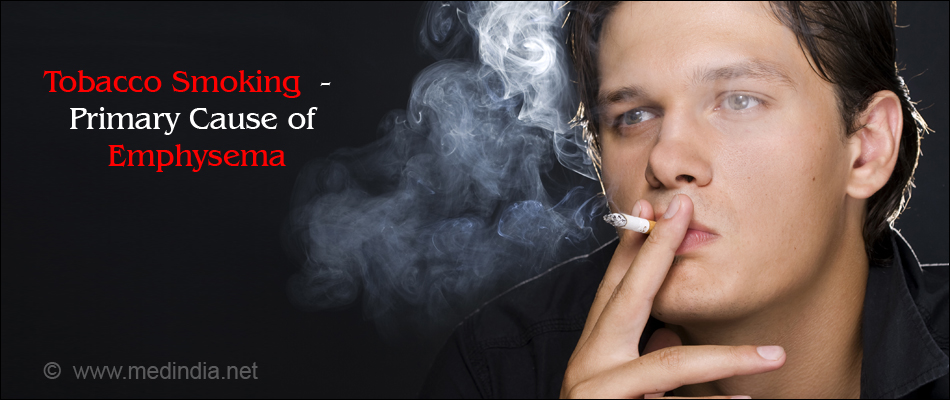 Tobacco Smoking - Primary Cause of Emphysema Tobacco Smoking - Primary Cause of Emphysema