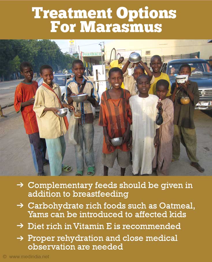 Treatment Options For Marasmus Treatment Options For Marasmus