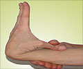 Hypermobility Syndrome - Signs - Symptoms - Causes - Diagnosis - Treatment
