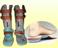 Orthotics - Types, Treatment & FAQs