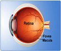 Retinal Detachment-Symptoms-Signs-Types-Complications-Treatment-Prognosis