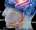 Salivary Gland Cancer-Causes-Types-Symptoms-Diagnosis-Treatment-FAQs