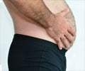 Abdomen Swelling and Fullness- Symptom Evaluation