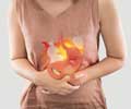 Acid Peptic Disease - Causes, Symptoms, Complications, Diagnosis and Treatment